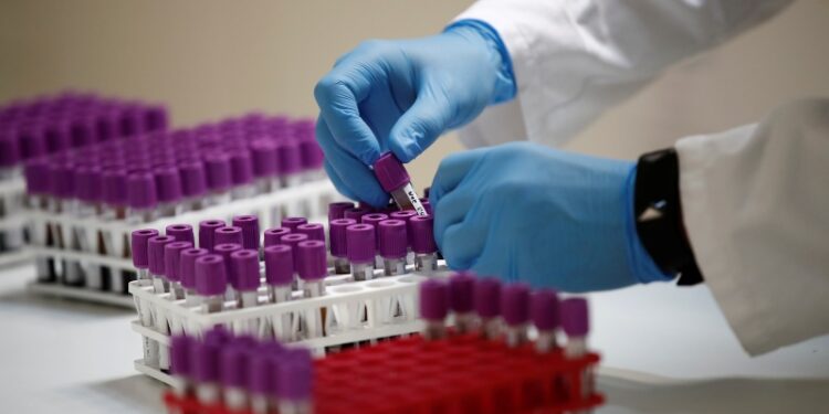 OMS renovará guía sobre Covid-19 para incluir “prometedores resultados” de dexametasona