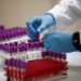 OMS renovará guía sobre Covid-19 para incluir “prometedores resultados” de dexametasona