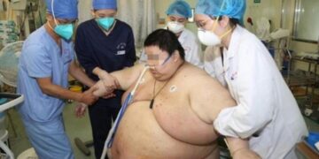 Hombre sube 100 kilos por pasar 5 meses confinado por la cuarentena