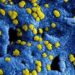 Investigación indica que COVID19 muta para que las células no lo reconozcan