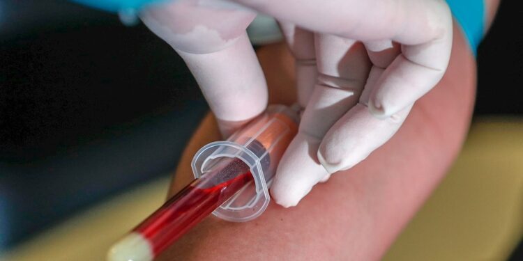 ONU alerta por medicinas falsas y vacunas ilegales contra covid-19