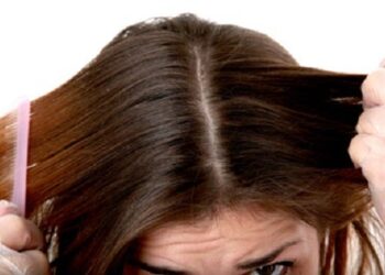 Cómo controlar el cabello graso