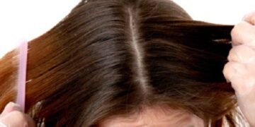 Cómo controlar el cabello graso
