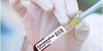Experto llama a probar vacuna del covid-19 en ancianos y en minorías raciales