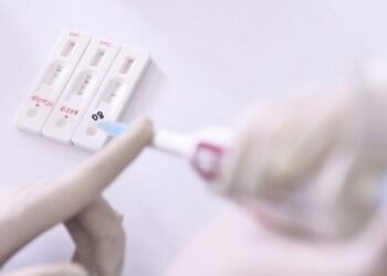 IMSS alista pruebas rápidas de Covid-19 e influenza