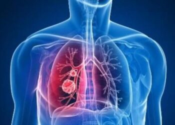 Descubren cómo se adhieren las bacterias que causan el 40% de neumonías atípicas