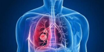 Descubren cómo se adhieren las bacterias que causan el 40% de neumonías atípicas
