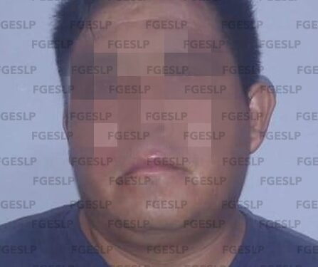 Detenido por lesionar a persona en Tancanhuitz