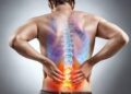 ¿Dolor de espalda?, podría deberse al sedentarismo y obesidad
