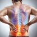 ¿Dolor de espalda?, podría deberse al sedentarismo y obesidad