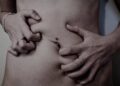 Piel, un espejo de lo que ocurre en el cuerpo