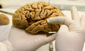 Crean banco de cerebros en la UNAM para investigación de Alzheimer