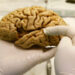 Crean banco de cerebros en la UNAM para investigación de Alzheimer