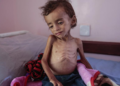 Yemen en “peligro inminente” de pasar por la peor hambruna del mundo: ONU