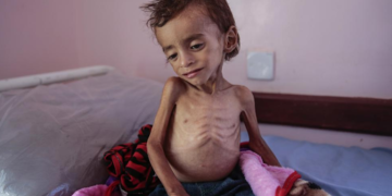 Yemen en “peligro inminente” de pasar por la peor hambruna del mundo: ONU