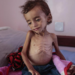 Yemen en “peligro inminente” de pasar por la peor hambruna del mundo: ONU