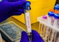 La OMS comenta la nueva variante de covid-19 detectada en el Reino Unido