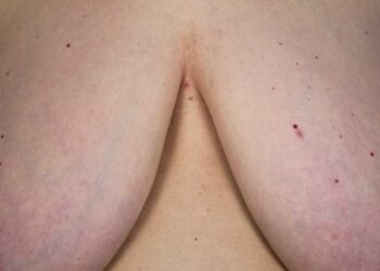 ‘Proyecto Tetas’, reflexión visual de concienciación y lucha contra la censura