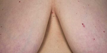 ‘Proyecto Tetas’, reflexión visual de concienciación y lucha contra la censura