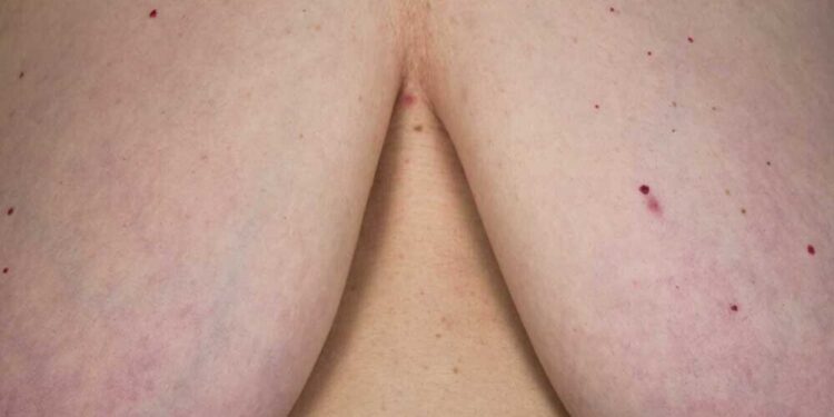 ‘Proyecto Tetas’, reflexión visual de concienciación y lucha contra la censura