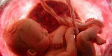 Encuentran microplásticos en placentas de mujeres embarazadas