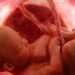 Encuentran microplásticos en placentas de mujeres embarazadas