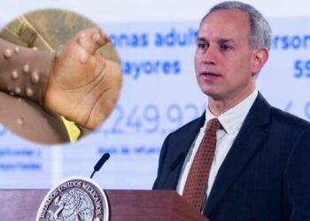 López-Gatell confirma primer caso de viruela del mono en México