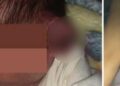 Practican cesárea con linternas de celular y le cortan la oreja al bebé en Mexicali