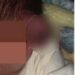 Practican cesárea con linternas de celular y le cortan la oreja al bebé en Mexicali