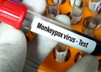 Suman más de dos mil casos de viruela del mono en todo el mundo