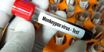 Suman más de dos mil casos de viruela del mono en todo el mundo
