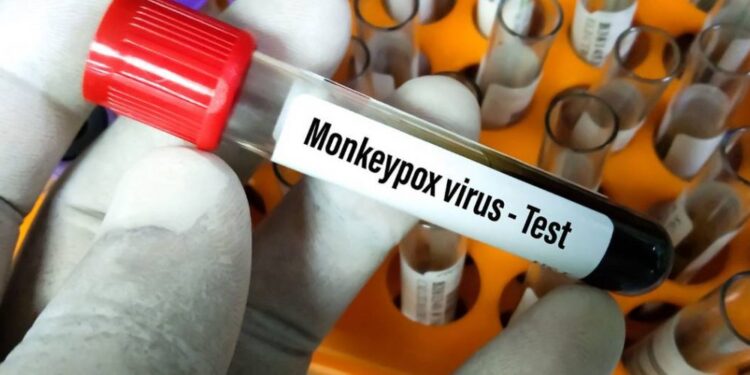 Suman más de dos mil casos de viruela del mono en todo el mundo