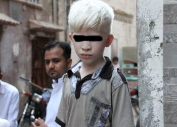 Detienen a hombre que intentó vender a sus hijos albinos para rituales de brujería