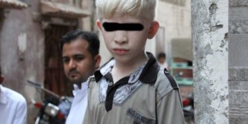 Detienen a hombre que intentó vender a sus hijos albinos para rituales de brujería