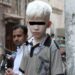 Detienen a hombre que intentó vender a sus hijos albinos para rituales de brujería