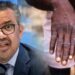 OMS declara la viruela del mono emergencia sanitaria internacional