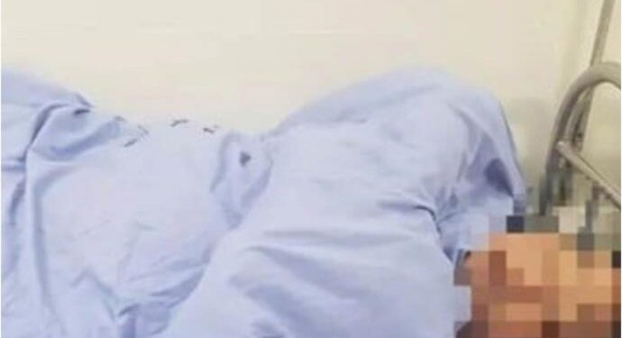 “Para darle una lección”; Mujer le corta genitales a su novio por tratar de violar a su hija