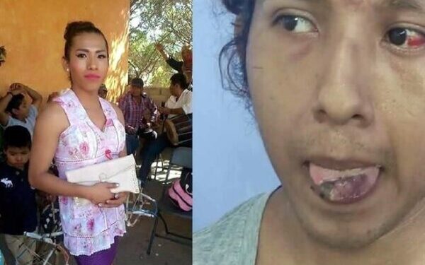 Mujer trans denunció que hijos de exalcalde de Jicayan, Oaxaca, intentaron cortarle la lengua