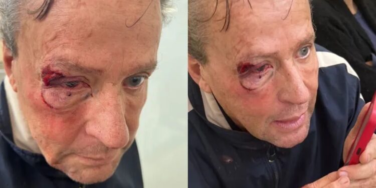 ¿Y el taekwondo? Golpean a Alfredo Adame afuera de su casa