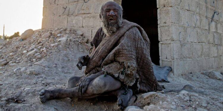 Muere el hombre “más sucio del mundo”; pasó más de ¡50 años sin bañarse!