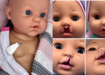 Fabrican muñecos inclusivos para niños discapacitados