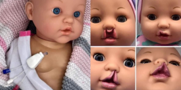 Fabrican muñecos inclusivos para niños discapacitados
