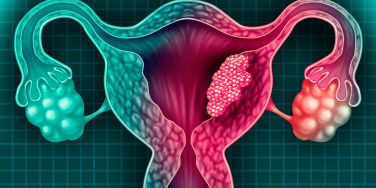 ¿Cáncer de útero por alaciarte el cabello seguido? Esto dice la ciencia