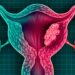 ¿Cáncer de útero por alaciarte el cabello seguido? Esto dice la ciencia