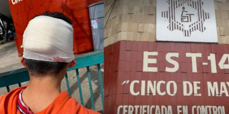 VIDEO| Un niño fue agredido por su compañero; le encajó un desarmador en la nuca