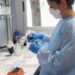 México confirma 1,968 casos de viruela símica