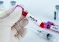 OMS cambiará el nombre de la viruela del mono a mpox