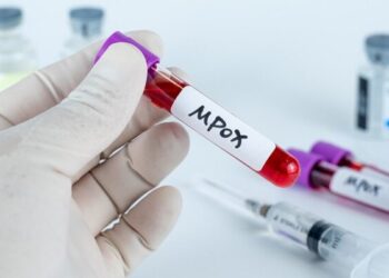 OMS cambiará el nombre de la viruela del mono a mpox