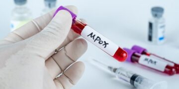 OMS cambiará el nombre de la viruela del mono a mpox