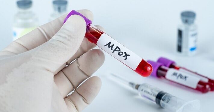 OMS cambiará el nombre de la viruela del mono a mpox